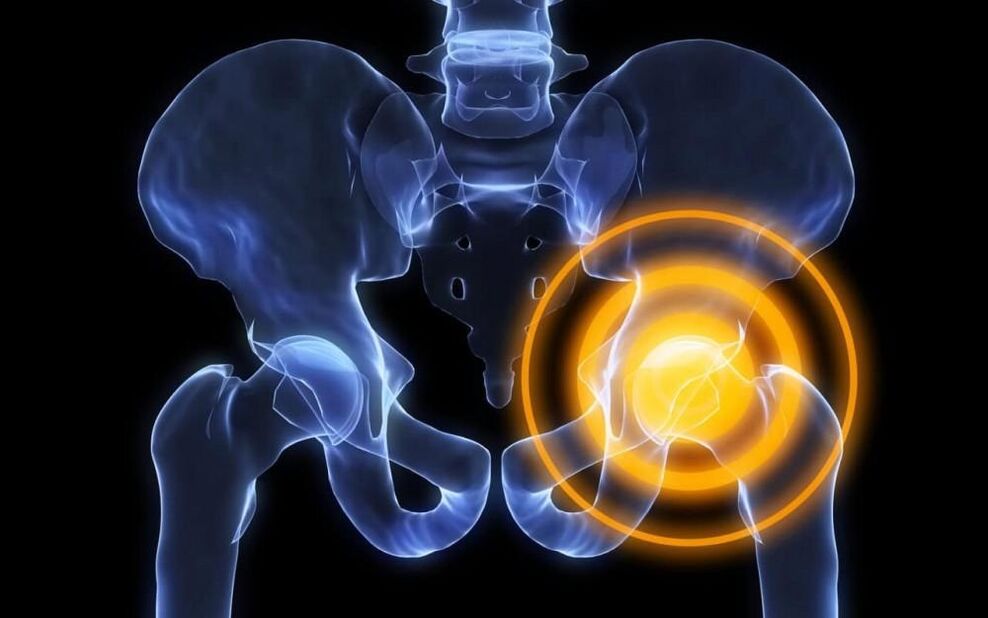 douleur dans l'articulation de la hanche image 2