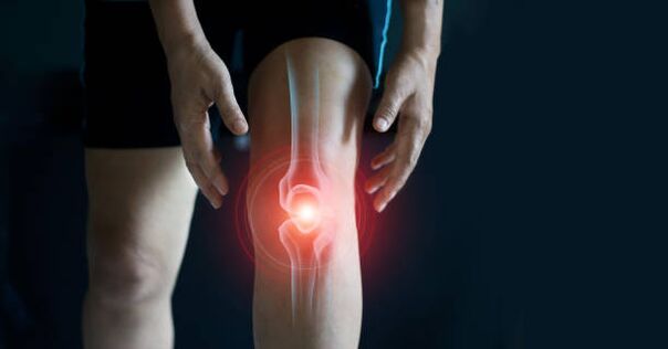 Arthrose de l'articulation du genou